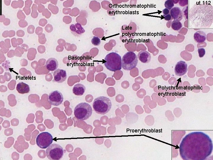 ut 112 Orthochromatophilic erythroblasts Late polychromatophilic erythroblast Basophilic erythroblast Platelets Polychromatophilic erythroblast Proerythroblast 