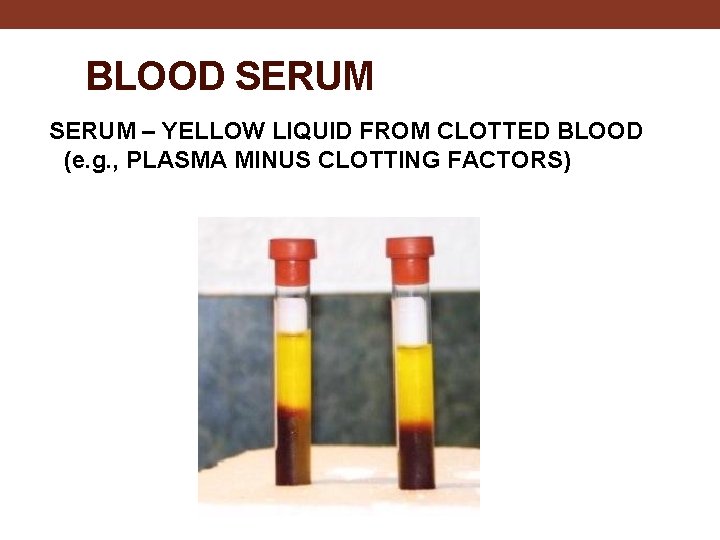 BLOOD SERUM – YELLOW LIQUID FROM CLOTTED BLOOD (e. g. , PLASMA MINUS CLOTTING