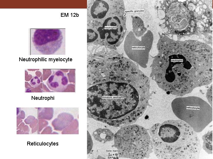 EM 12 b Neutrophilic myelocyte Neutrophi Reticulocytes 