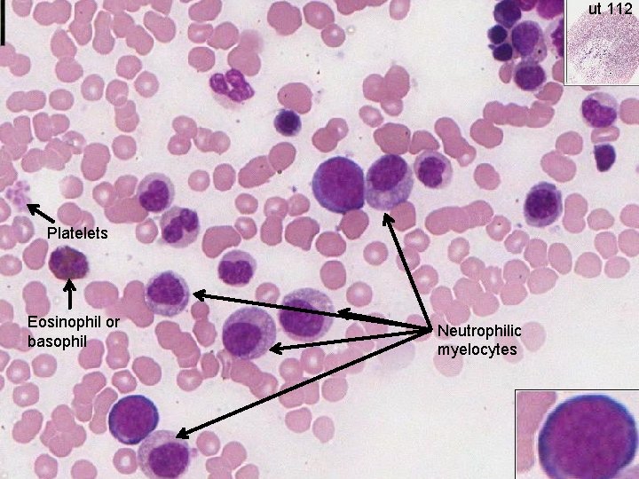 ut 112 Platelets Eosinophil or basophil Neutrophilic myelocytes 