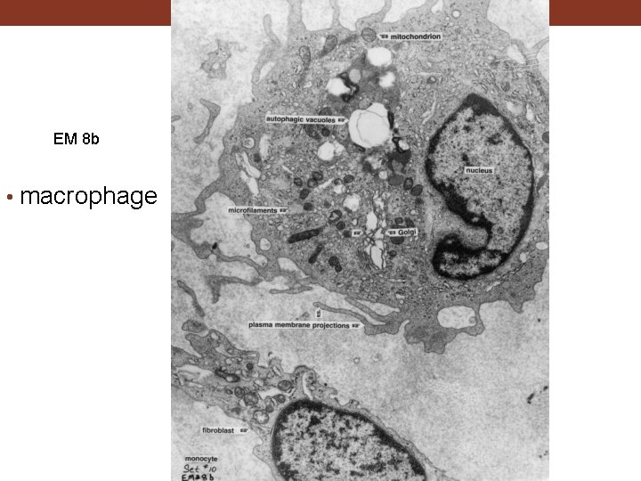 EM 8 b • macrophage 