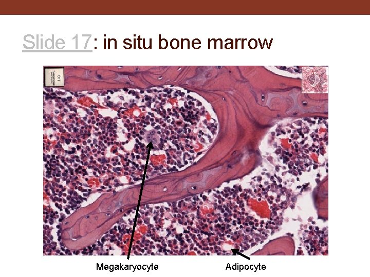 Slide 17: in situ bone marrow Megakaryocyte Adipocyte 