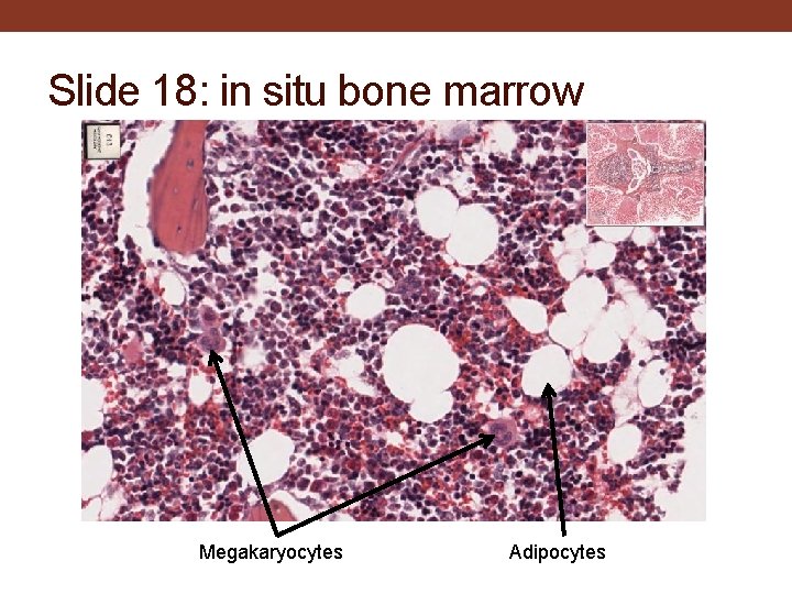 Slide 18: in situ bone marrow Megakaryocytes Adipocytes 