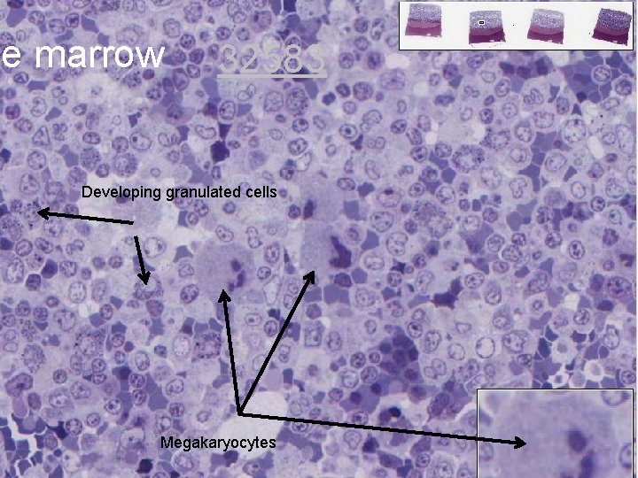 ne marrow 32583 Developing granulated cells Megakaryocytes 