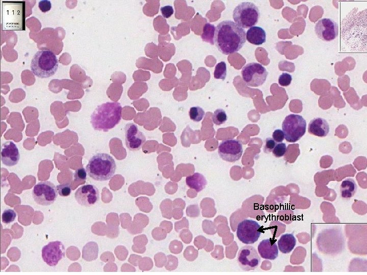 Basophilic erythroblast 