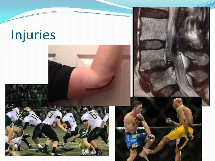 Injuries 