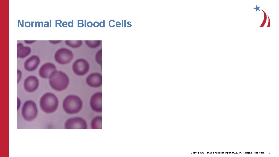Normal Red Blood Cells Copyright © Texas Education Agency, 2017. All rights reserved. 3
