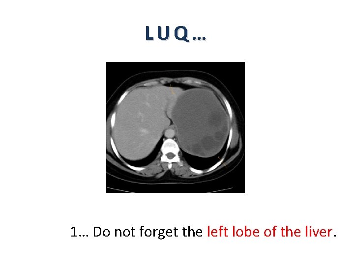 LUQ… 1… Do not forget the left lobe of the liver. 
