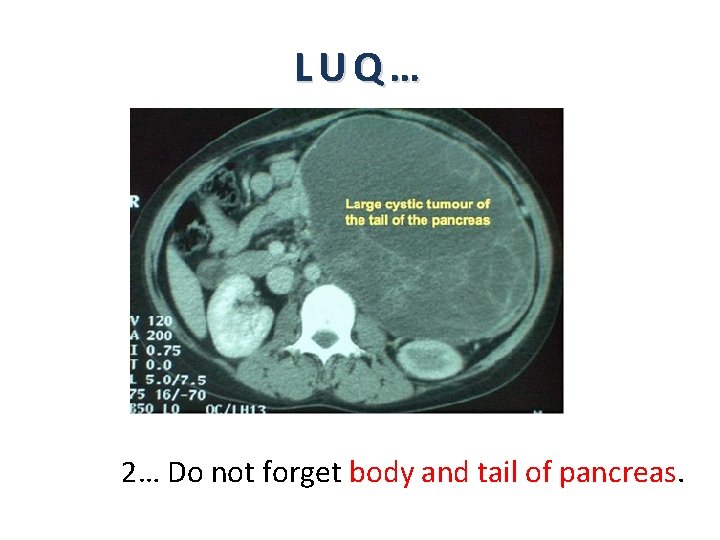 LUQ… 2… Do not forget body and tail of pancreas. 