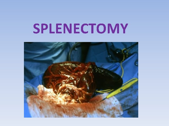 SPLENECTOMY 