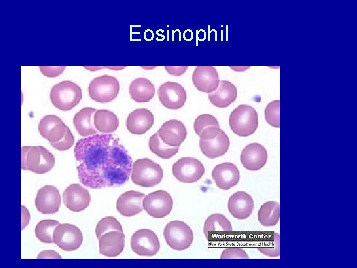 Eosinophil 