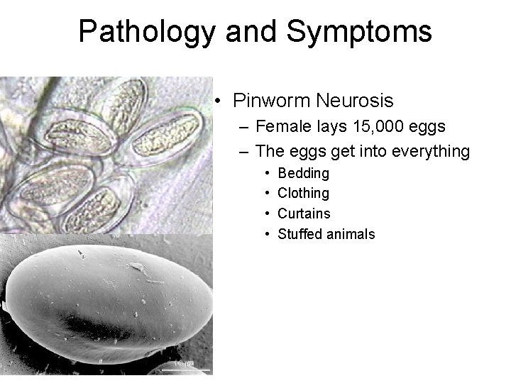 Pathology and Symptoms • Pinworm Neurosis – Female lays 15, 000 eggs – The