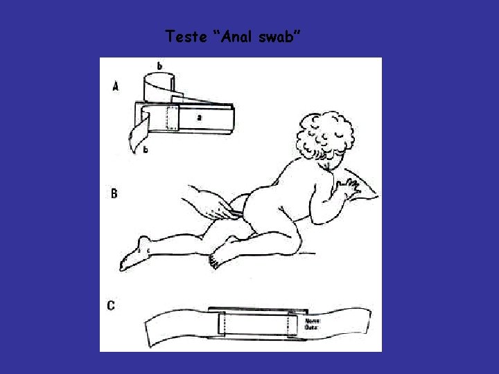 Teste “Anal swab” 