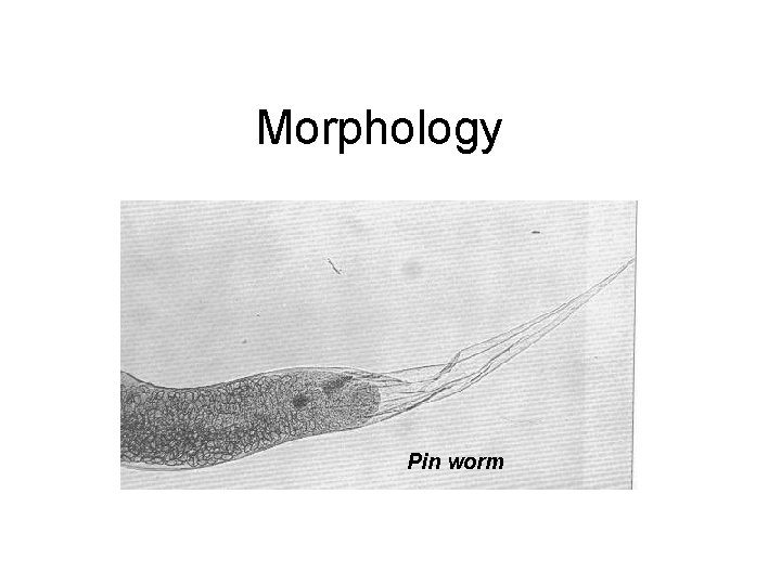 Morphology Pin worm 