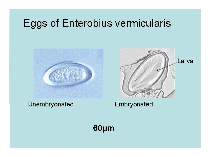 Eggs of Enterobius vermicularis Larva Unembryonated Embryonated 60µm 