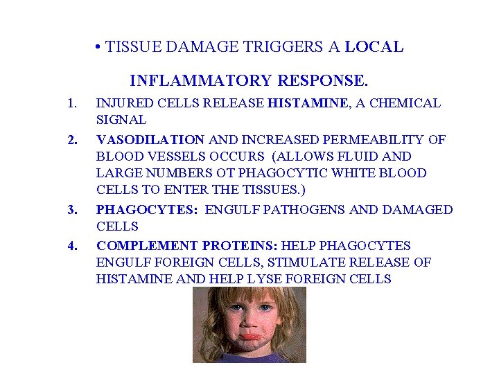  • TISSUE DAMAGE TRIGGERS A LOCAL INFLAMMATORY RESPONSE. 1. 2. 3. 4. INJURED