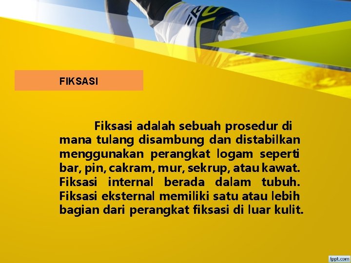 FIKSASI Fiksasi adalah sebuah prosedur di mana tulang disambung dan distabilkan menggunakan perangkat logam