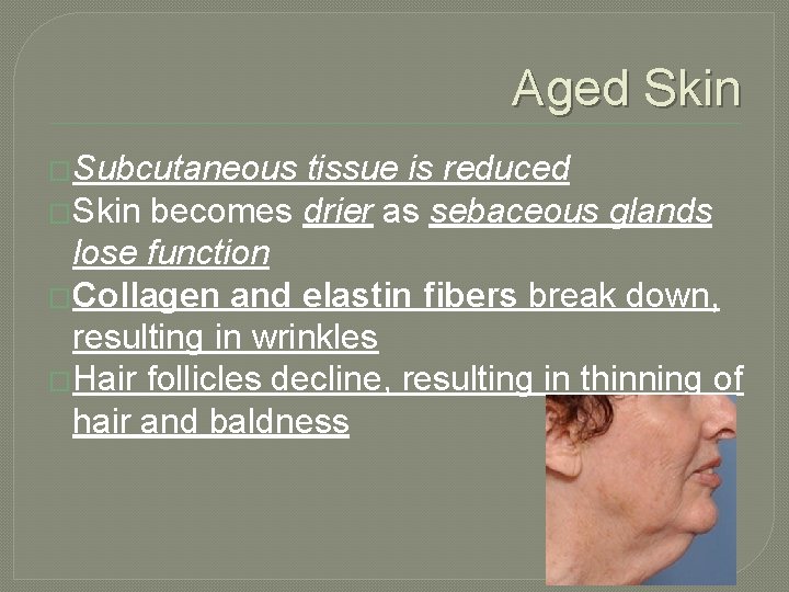 Aged Skin �Subcutaneous tissue is reduced �Skin becomes drier as sebaceous glands lose function