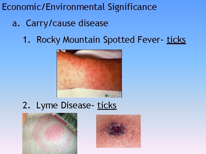 Economic/Environmental Significance a. Carry/cause disease 1. Rocky Mountain Spotted Fever- ticks 2. Lyme Disease-