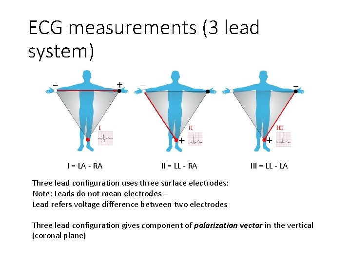 ECG measurements (3 lead system) I = LA - RA II = LL -