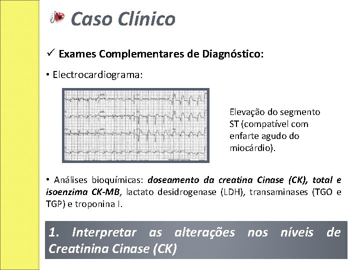 Caso Clínico ü Exames Complementares de Diagnóstico: • Electrocardiograma: Elevação do segmento ST (compatível