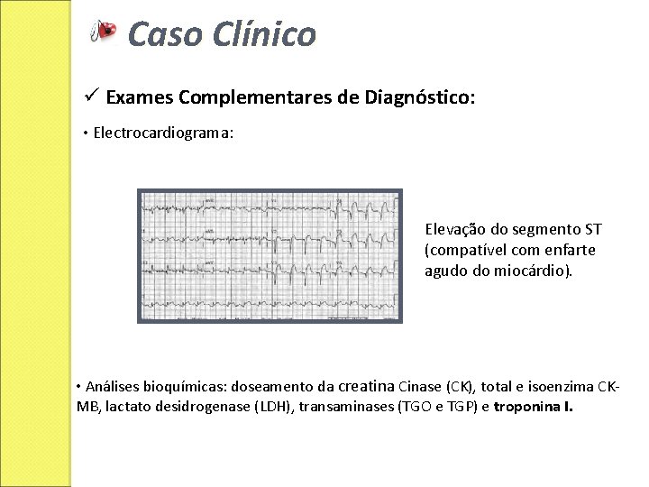 Caso Clínico ü Exames Complementares de Diagnóstico: • Electrocardiograma: Elevação do segmento ST (compatível