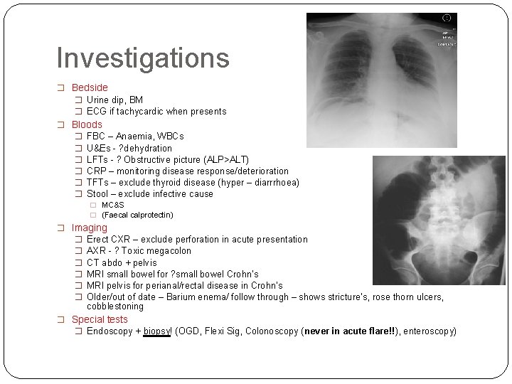 Investigations � Bedside � Urine dip, BM � ECG if tachycardic when presents �