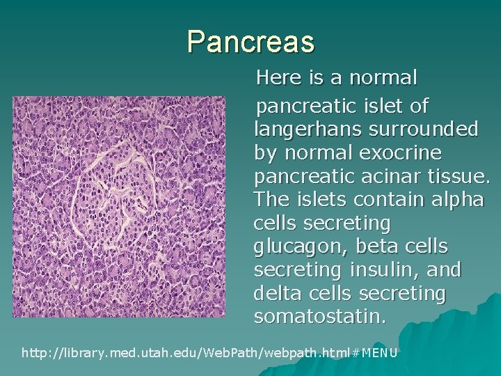 Pancreas Here is a normal pancreatic islet of langerhans surrounded by normal exocrine pancreatic