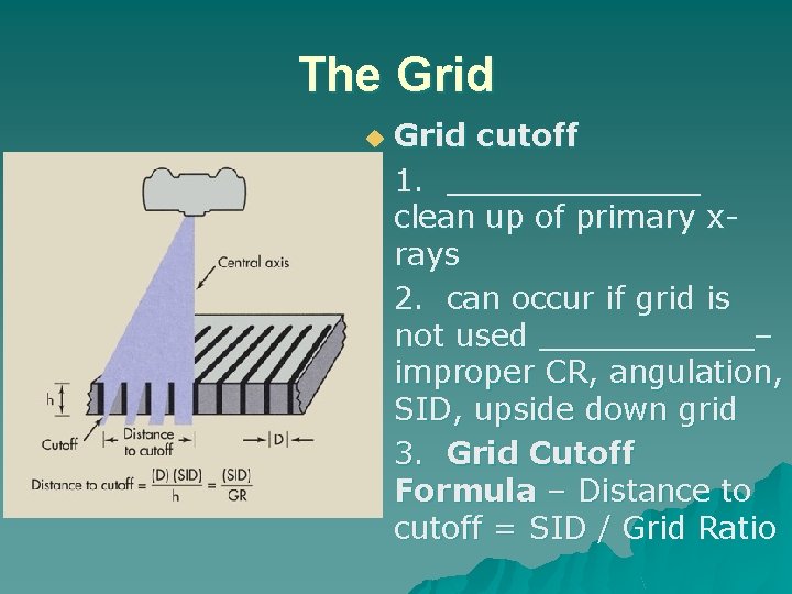 The Grid u Grid cutoff 1. _______ clean up of primary xrays 2. can