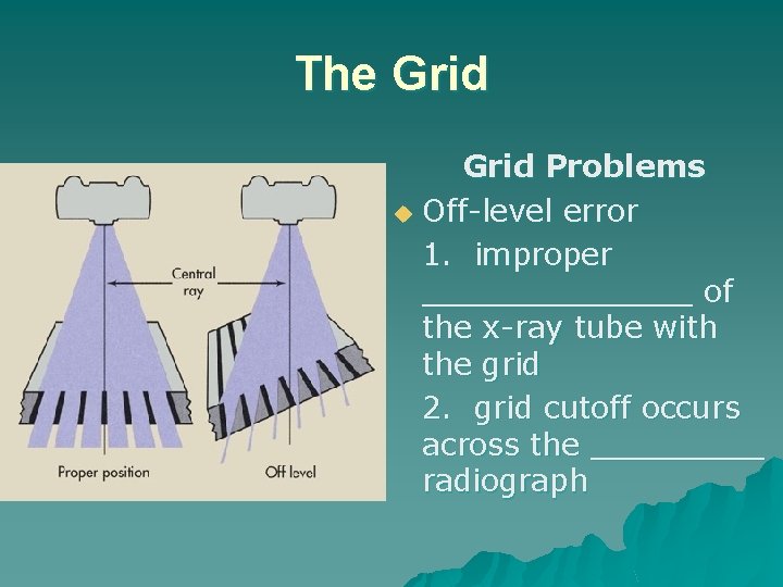 The Grid Problems u Off-level error 1. improper _______ of the x-ray tube with