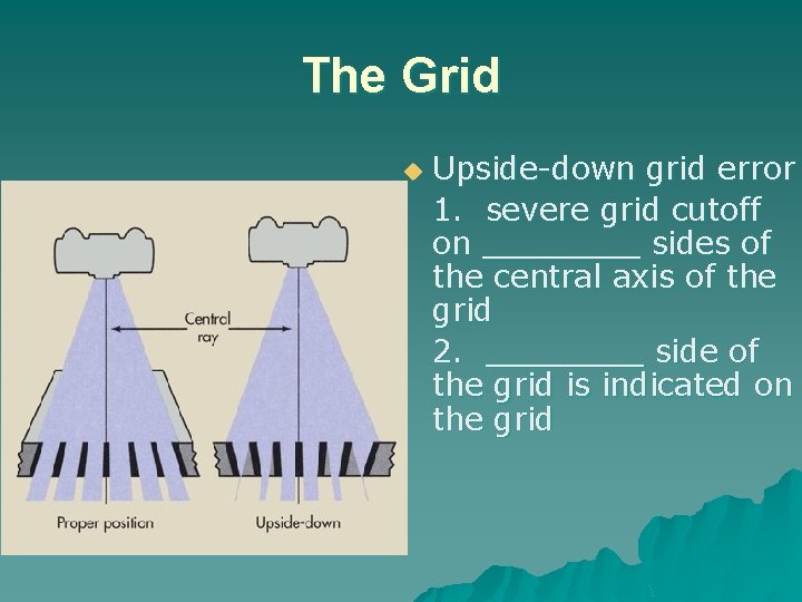 The Grid u Upside-down grid error 1. severe grid cutoff on ____ sides of
