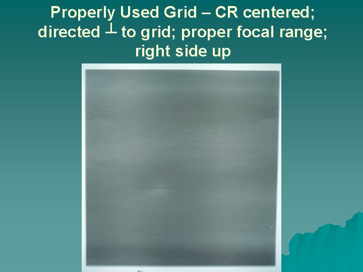 Properly Used Grid – CR centered; directed ┴ to grid; proper focal range; right