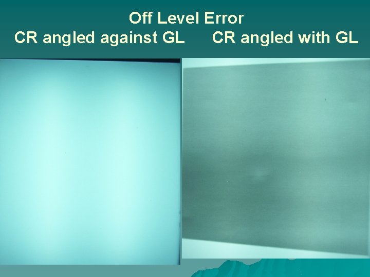Off Level Error CR angled against GL CR angled with GL 