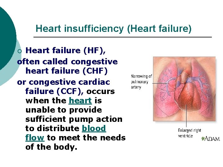 Heart insufficiency (Heart failure) Heart failure (HF), often called congestive heart failure (CHF) or