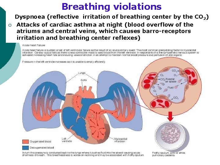 Breathing violations ¡ Dyspnoea (reflective irritation of breathing center by the СО 2) Attacks