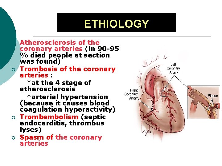 ЕТHІОLOGY ¡ ¡ Atherosclerosis of the coronary arteries (in 90 -95 % died people