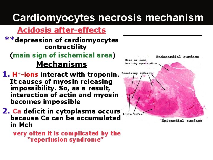 Cardiomyocytes necrosis mechanism Acidosis after-effects **depression of cardiomyocytes contractility (main sign of ischemical area)