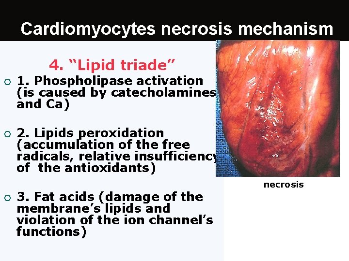 Cardiomyocytes necrosis mechanism 4. “Lipid triade” ¡ 1. Phospholipase activation (is caused by catecholamines