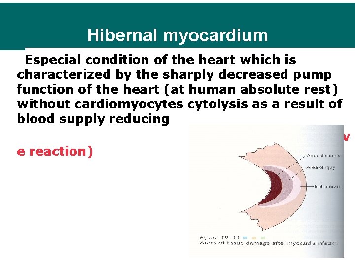 Hibernal myocardium Especial condition of the heart which is characterized by the sharply decreased