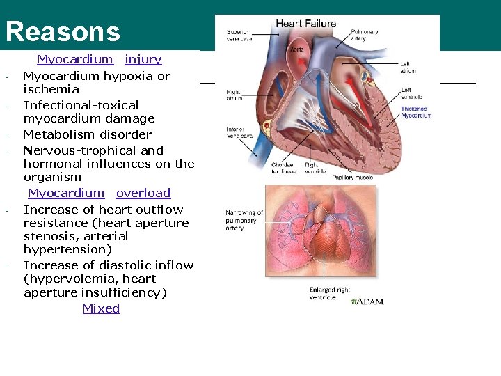 Reasons - - - Myocardium injury Myocardium hypoxia or ischemia Infectional-toxical myocardium damage Metabolism