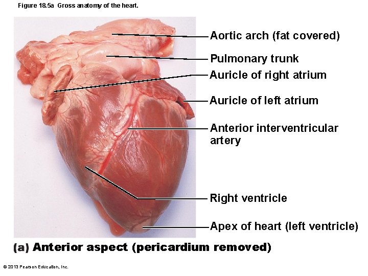 Figure 18. 5 a Gross anatomy of the heart. Aortic arch (fat covered) Pulmonary