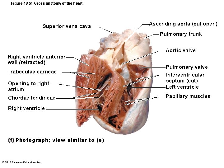 Figure 18. 5 f Gross anatomy of the heart. Superior vena cava Ascending aorta