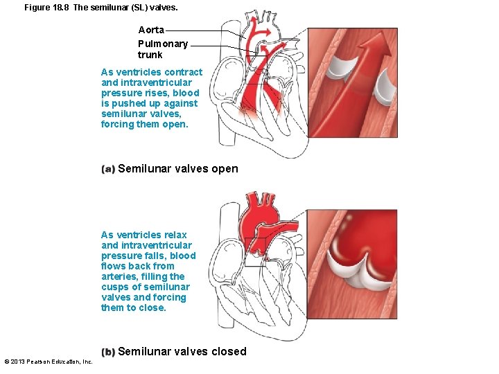 Figure 18. 8 The semilunar (SL) valves. Aorta Pulmonary trunk As ventricles contract and
