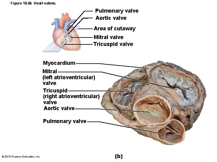 Figure 18. 6 b Heart valves. Pulmonary valve Aortic valve Area of cutaway Mitral