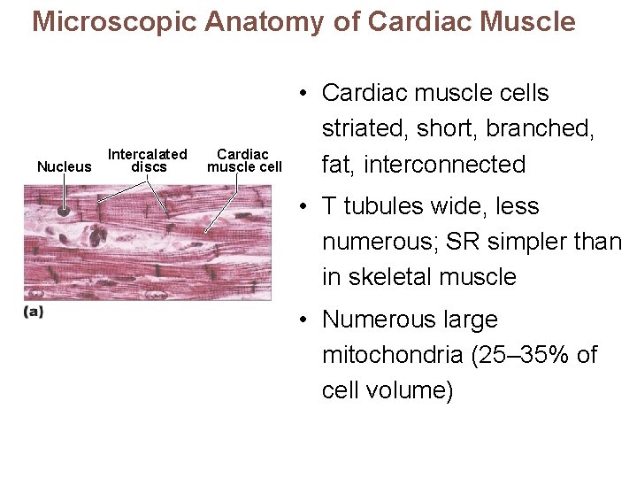 Microscopic Anatomy of Cardiac Muscle Nucleus Intercalated discs Cardiac muscle cell • Cardiac muscle