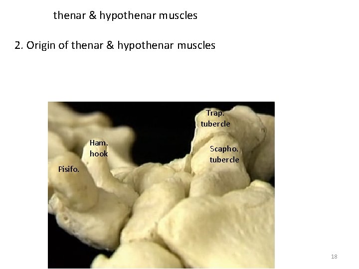 thenar & hypothenar muscles 2. Origin of thenar & hypothenar muscles Trap. tubercle Ham.