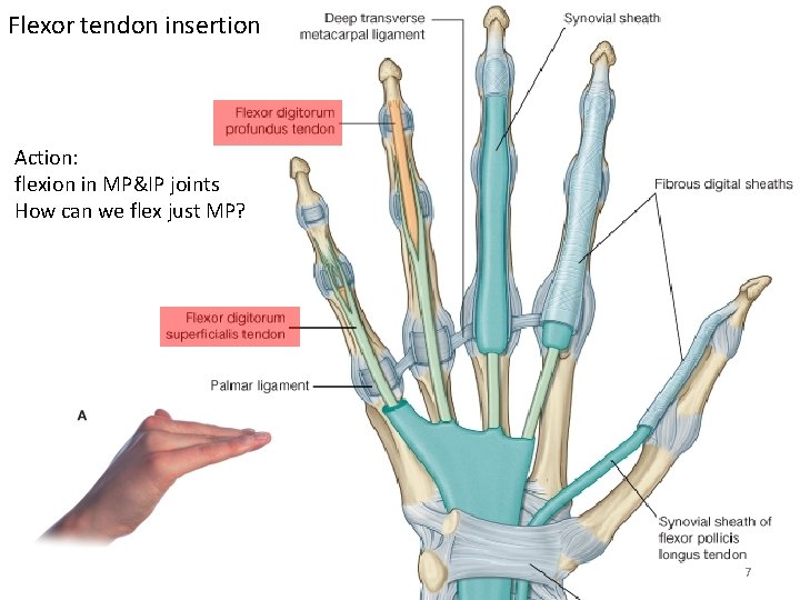 Flexor tendon insertion Action: flexion in MP&IP joints How can we flex just MP?