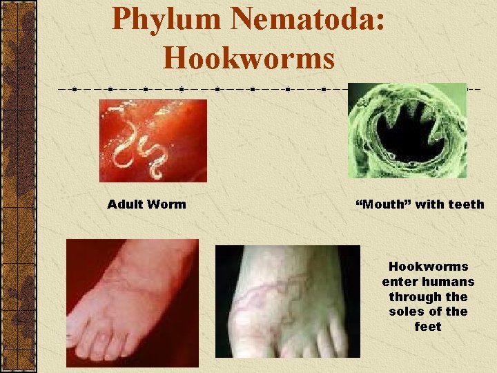 Phylum Nematoda: Hookworms Adult Worm “Mouth” with teeth Hookworms enter humans through the soles