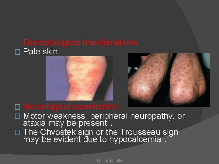 Dermatological manifestations � Pale skin Neurological examination Motor weakness, peripheral neuropathy, or ataxia may