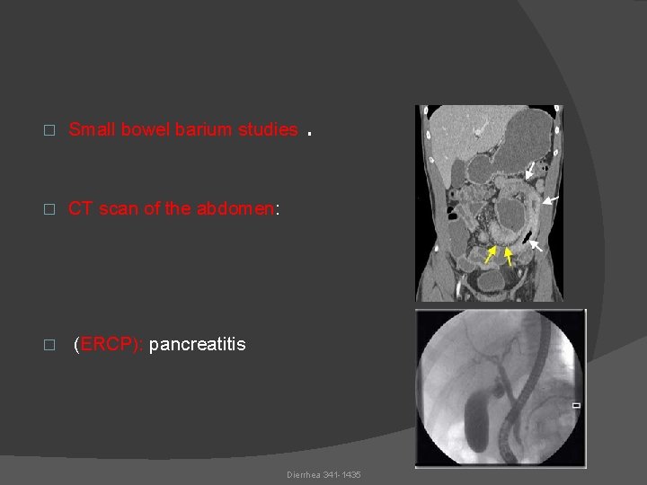 � Small bowel barium studies � CT scan of the abdomen: � . (ERCP):